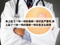 身上起了一块一块的像癣一样红色严重吗 身上起了一块一块的像癣一样红色怎么回事