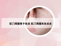 肛门周围有个白点 肛门周围长白点点