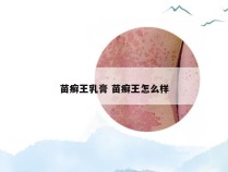 苗癣王乳膏 苗癣王怎么样