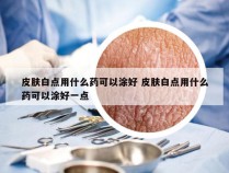 皮肤白点用什么药可以涂好 皮肤白点用什么药可以涂好一点