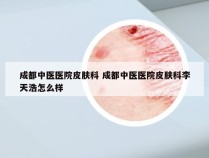 成都中医医院皮肤科 成都中医医院皮肤科李天浩怎么样