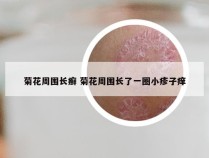 菊花周围长癣 菊花周围长了一圈小疹子痒