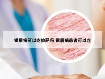 银屑病可以吃披萨吗 银屑病患者可以吃