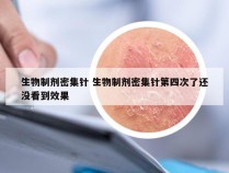 生物制剂密集针 生物制剂密集针第四次了还没看到效果