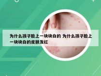 为什么孩子脸上一块块白的 为什么孩子脸上一块块白的皮肤发红