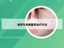 南京牛皮癣医院治疗方法