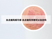 白点癫风痒不痒 白点癫风早期可以自愈吗