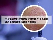 小儿银屑病的中西医结合治疗偏方 小儿银屑病的中西医结合治疗偏方有哪些