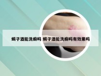 蝎子酒能洗癣吗 蝎子酒能洗癣吗有效果吗