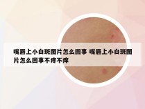 嘴唇上小白斑图片怎么回事 嘴唇上小白斑图片怎么回事不疼不痒