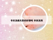 辛氏洗癣方真的好使吗 辛扶洗剂