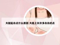 大腿起白点什么原因 大腿上长许多白白的点