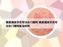 银屑病关节炎可以办门规吗 银屑病关节炎可以办门规吗能治好吗