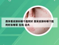 西安看皮肤科哪个医院好 西安皮肤科哪个医院好去哪家 在线 远大