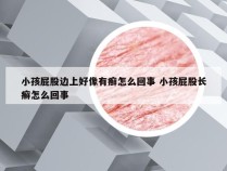 小孩屁股边上好像有癣怎么回事 小孩屁股长癣怎么回事