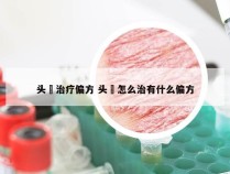 头廯治疗偏方 头廯怎么治有什么偏方