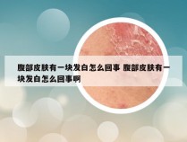 腹部皮肤有一块发白怎么回事 腹部皮肤有一块发白怎么回事啊