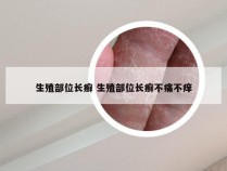 生殖部位长癣 生殖部位长癣不痛不痒