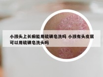 小孩头上长癣能用硫磺皂洗吗 小孩有头皮屑可以用硫磺皂洗头吗