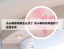 冯小刚白斑病怎么没了 冯小刚的白斑是好了还是全白