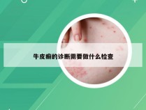 牛皮癣的诊断需要做什么检查