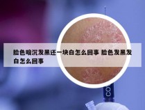 脸色暗沉发黑还一块白怎么回事 脸色发黑发白怎么回事