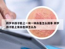 四岁半孩子脸上一块一块白是怎么回事 四岁孩子脸上有白色块怎么办