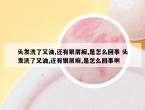 头发洗了又油,还有银屑癣,是怎么回事 头发洗了又油,还有银屑癣,是怎么回事啊