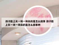 孩子脸上长一块一块白的是怎么回事 孩子脸上长一块一块白的是怎么回事啊