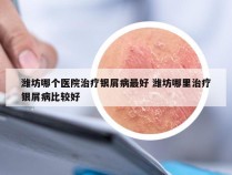 潍坊哪个医院治疗银屑病最好 潍坊哪里治疗银屑病比较好