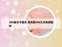 308准分子激光 激光做308几次白斑能好