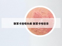 联苯卡挫喷头癣 联苯卡唑软膏