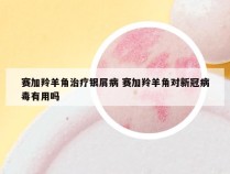 赛加羚羊角治疗银屑病 赛加羚羊角对新冠病毒有用吗