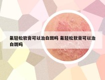 氟轻松软膏可以治白斑吗 氟轻松软膏可以治白斑吗