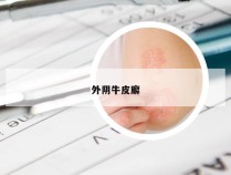 外阴牛皮廨