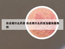 白点用什么药膏 白点用什么药膏治最快最有效