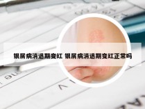 银屑病消退期变红 银屑病消退期变红正常吗