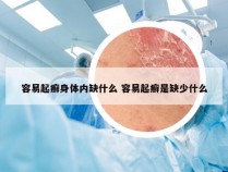 容易起癣身体内缺什么 容易起癣是缺少什么