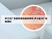 庐江马厂皮肤科真的很神奇吗 庐江县马厂皮肤病科