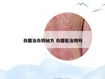 白醋治白斑秘方 白醋能治斑吗