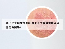 身上长了很多斑点藓 身上长了好多斑斑点点是怎么回事?