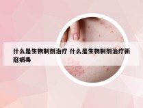 什么是生物制剂治疗 什么是生物制剂治疗新冠病毒