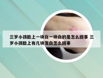 三岁小孩脸上一块白一块白的是怎么回事 三岁小孩脸上有几块发白怎么回事