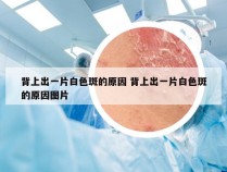 背上出一片白色斑的原因 背上出一片白色斑的原因图片