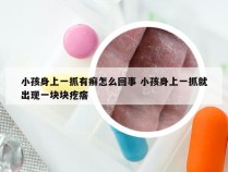 小孩身上一抓有癣怎么回事 小孩身上一抓就出现一块块疙瘩