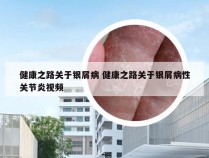 健康之路关于银屑病 健康之路关于银屑病性关节炎视频