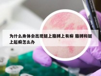 为什么身体会出现腿上胳膊上有癣 胳膊和腿上起癣怎么办