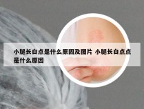 小腿长白点是什么原因及图片 小腿长白点点是什么原因