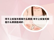 项子上反复长癣是什么原因 项子上反复长癣是什么原因造成的