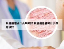 银屑病泡点什么喝喝好 银屑病患者喝什么茶比较好